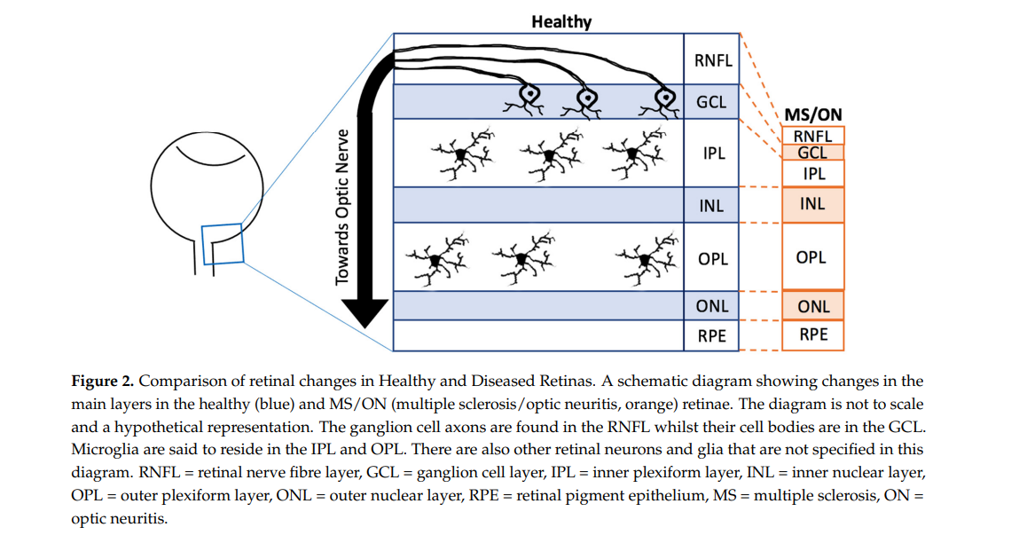 boost memory boost memory